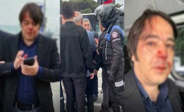 Üsküdar’daki kaçak kafe yıkımında İBB İmar Müdürü darbedildi